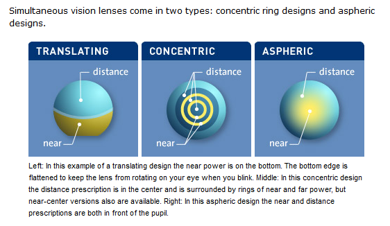 Bifocal Contact Lenses Designs